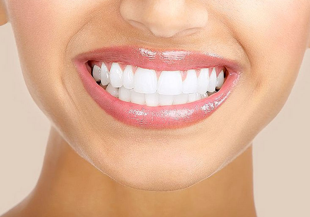Bright, confident smile — Bright Smile Dental Clinic